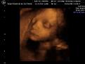 Click image for larger version

Name:	250pix.JPG
Views:	73
Size:	8.4 KB
ID:	258127