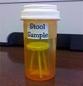 Click image for larger version

Name:	Stool Sample.jpg
Views:	214
Size:	21.4 KB
ID:	262326